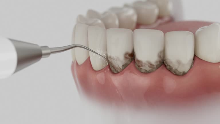 Trusted Teeth Cleaning And Checkup service in Huntsville, TN - Dentist Open Now